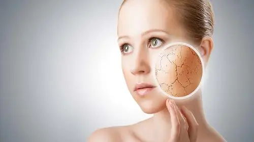 春天皮肤干燥起皮如何补水2个方法快速补充水分