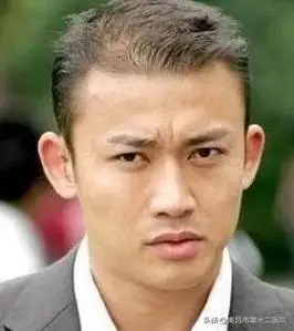 明星植发也是非常普遍的,所以希望广大发友清楚一件事情,并不是光头