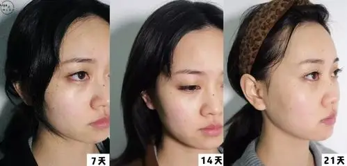 长期熬夜对人的容貌影响有多大 ?