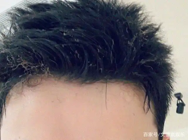 吴磊头发被烧焦,我们的"吴管家"也是太拼了