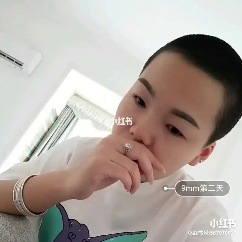 9mm 寸头 一个月 这么看确实长了不少