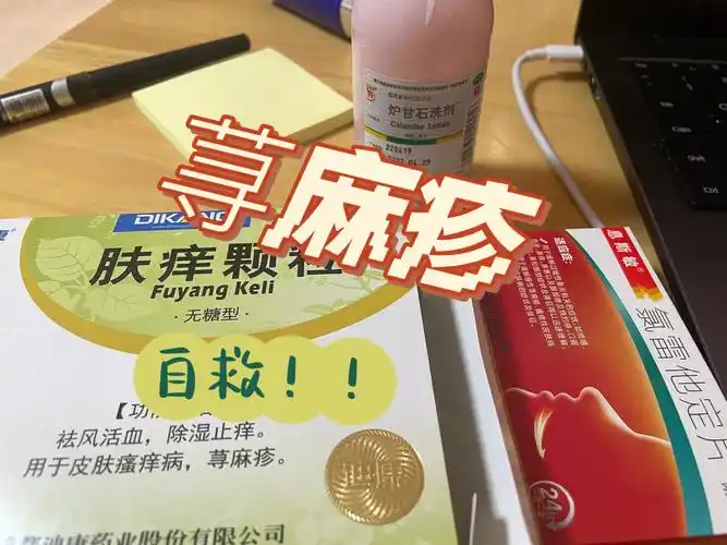 7315 炉甘石洗剂虽然有点干燥,但是说实话 真的可以缓解一下痒!