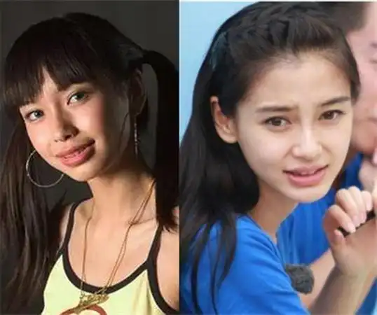 从凸嘴龅牙到真人芭比再到红毯杀手baby的脸发生了哪些变化