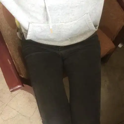 真心求教女生腿缝大是不是真的很难看