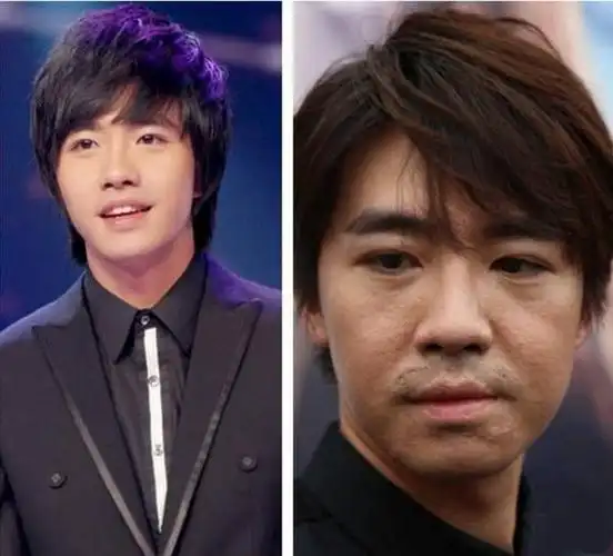 11年过去了从美男子到毁容俞灏明还好吗