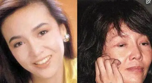 盘点世界十大最可怕的整容失败案例你还敢在脸上动刀子吗2