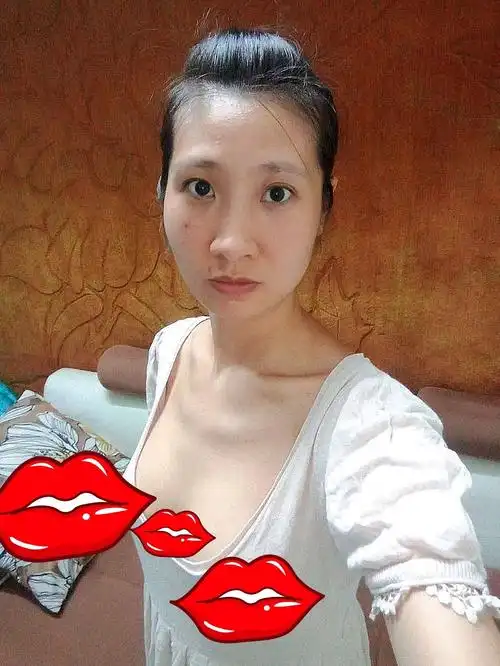 假体隆胸术后8天,不穿内衣胸部也很挺,又挺又自然,_圈子-新氧美容整形