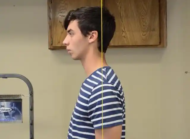 经典3个动作解决脖子前倾问题, 有简有难