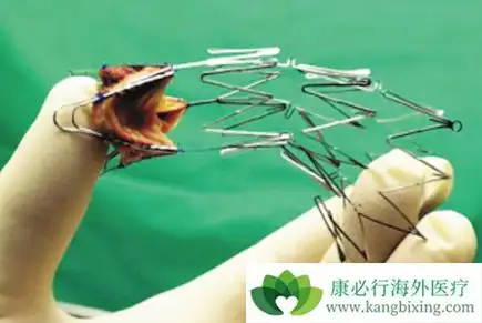 做了心脏支架手术后患者要警惕哪些问题