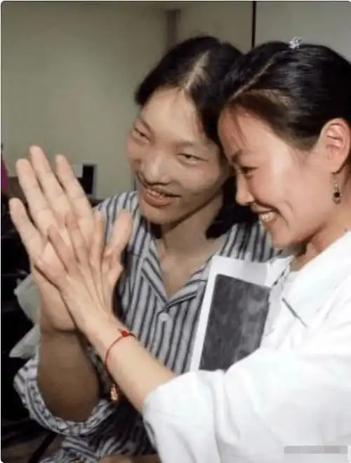 第一女巨人姚德芬身高24米最大心愿是吃饱饭她经历了啥