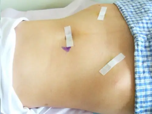 科学使用创可贴