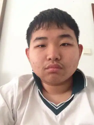 他同学都说他丑.他很自卑.