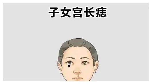 身体4颗破财痣大钱无小钱光一分钱也留不住后半生穷