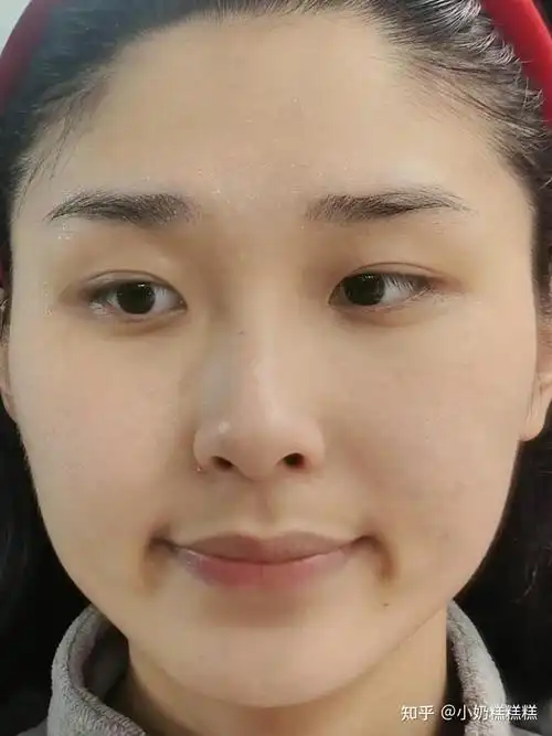 皮肤黑黄又暗沉女孩必看!怎样才能和明星一样白到发光?