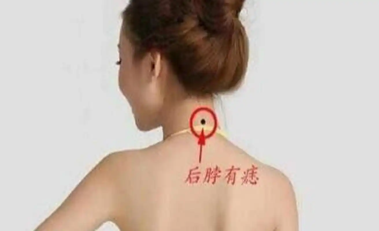 脖子后面有痣你不知道的寓意 脖子后的痣寓意好坏皆有,好的一方面