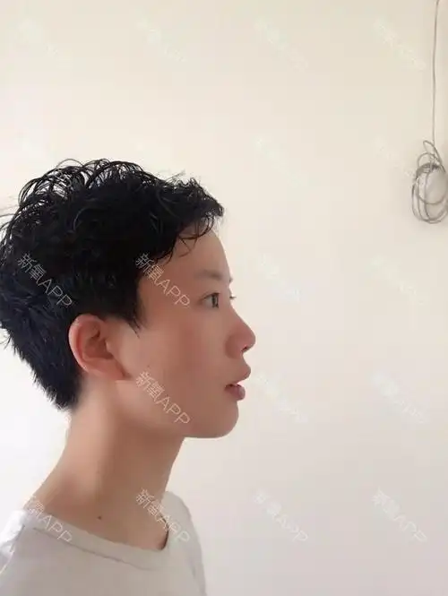 又来分享我的众多90度侧脸45度侧脸各种侧脸了?实_圈子-新氧美容整形