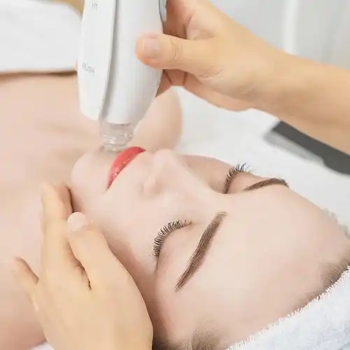 cici纤美q3氢气气泡科技美容面部深层清洁美容