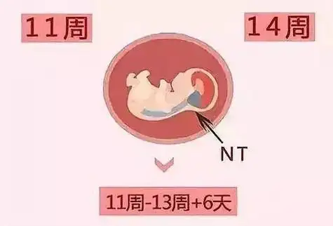nt值能看男女吗孕12周nt暗示男女吗