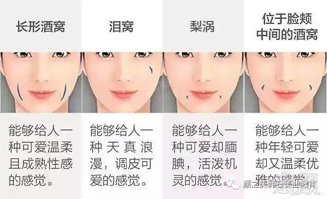 酒窝梨涡形成术