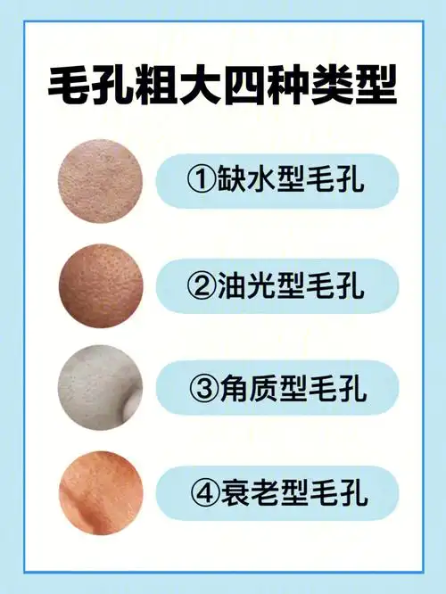 你是哪种类型毛孔71不要再被缩毛孔骗了60