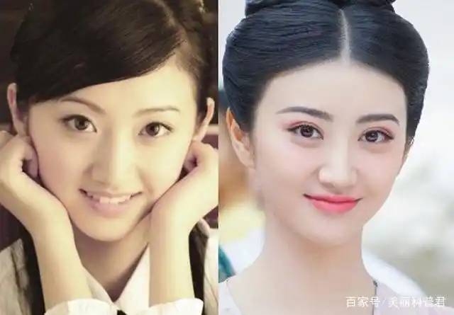 其实景甜是有双眼皮的,刚出道的时候,景甜的双眼皮很很窄