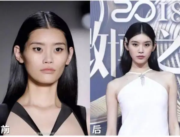 医美64命理64好面相设计分享会揭秘奚梦瑶