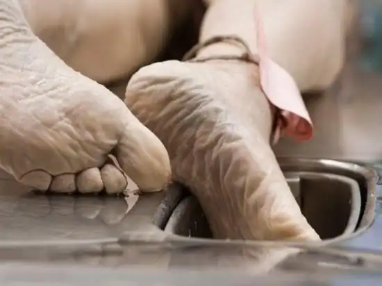 认识死亡太平间处理后事纪实