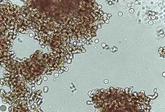 解析交叉配血中常见的凝集反应