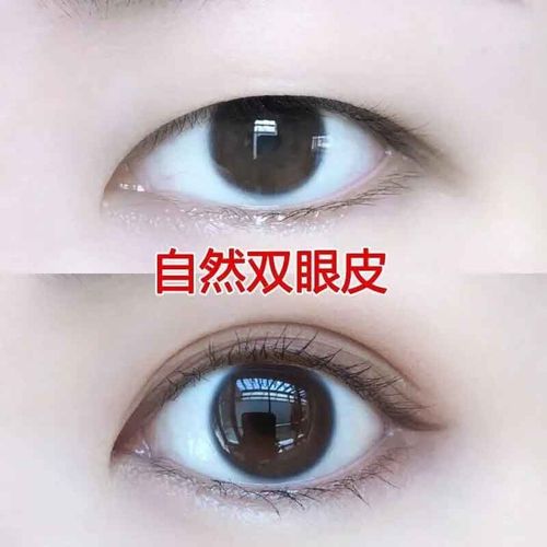 药房直售大眼精油扩眼单眼皮变双眼皮卧蚕眼睛变大扩眼角去浮肿泡 一