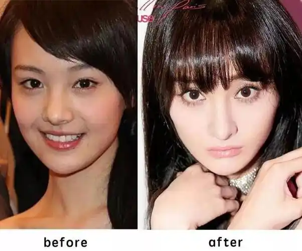 郑爽整容后,郑爽再整容?"变脸"后又像倪妮又像娜扎 - 冷思维