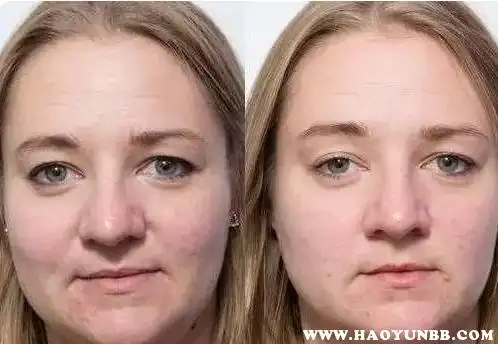 正常脸与熬夜脸对比