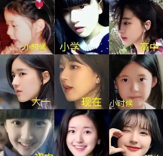 赵露思深陷整容舆论!