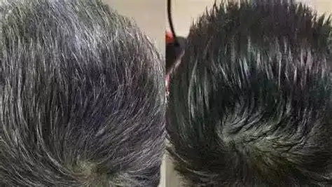 什么洗发水能让白发变黑发?