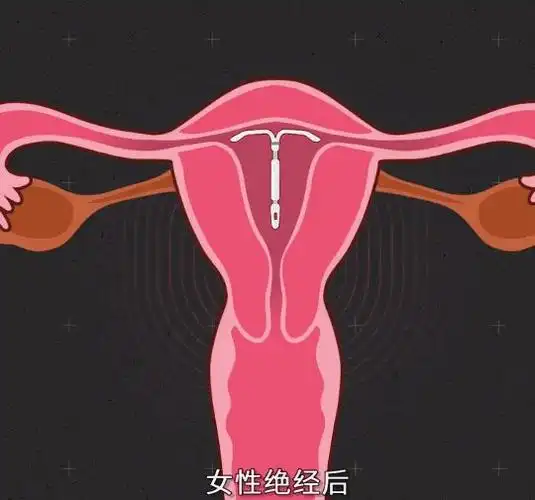 2600万女人体内藏有一颗定时炸弹避孕是共同的责任