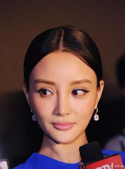 看看这几位明星的双眼皮,割得恰到好处