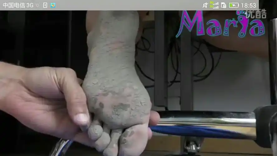 踩了水泥会这样吗?