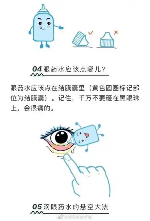 文理小天地##原来眼药水是滴在下眼睑