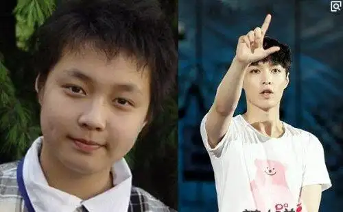 张艺兴整容前真吓人张艺兴整容前后对比照曝光图