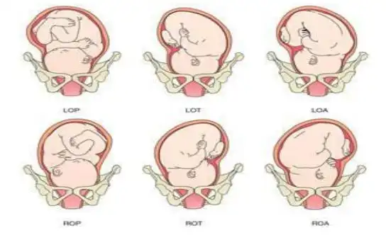 医生,宝宝的胎位正吗