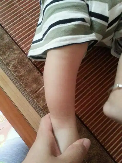 宝宝的腿弯吗?怕怕 - 2014年11月妈妈帮 - 妈妈帮