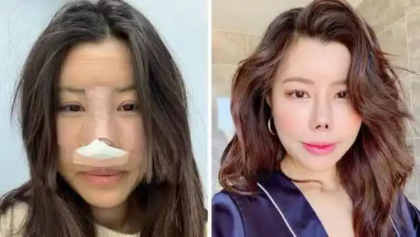 整容失败案例著名明星_香港整容失败老明星_整容失败的明星新闻