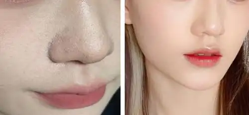 第一步:脸部去角质