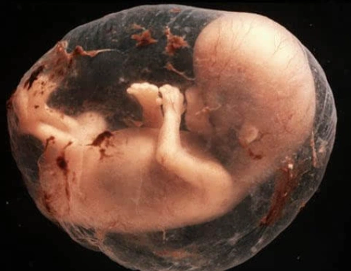 怀孕期间吃4种食物,易造成胎儿畸形和兔唇的风险,孕期需杜绝