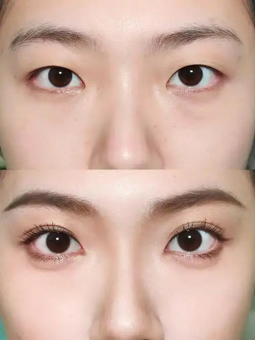 单眼皮有效眼妆:双眼皮贴 修容 太阳花睫毛