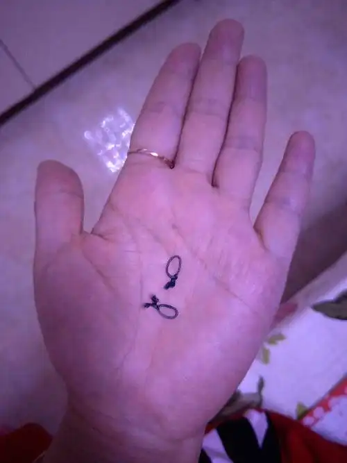 我子宫全切术后阴道掉出来俩个一样大的线环,是什么情况啊?