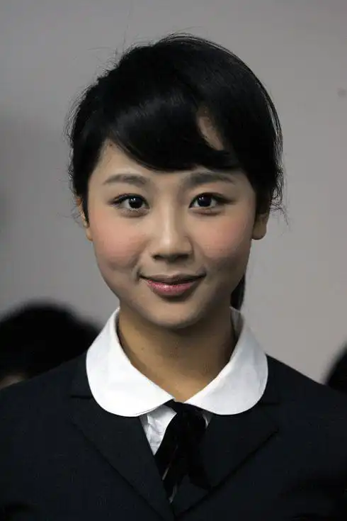 找女演员隆额头的照片 开始疑惑杨紫到底有没有整?