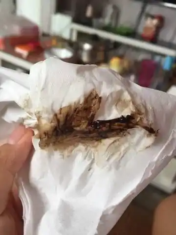 怀孕四十多天了 每天都有褐色的血