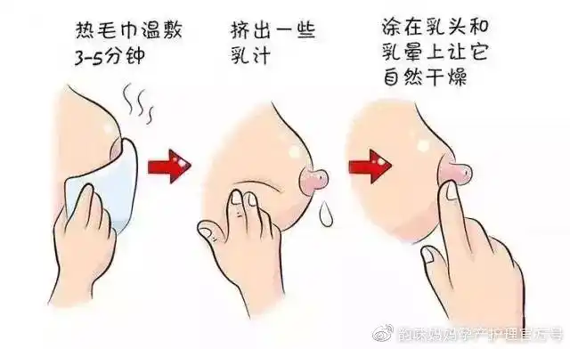 图片72乳头皲裂严重的妈妈,可以暂时用吸奶器吸出奶水喂宝宝.
