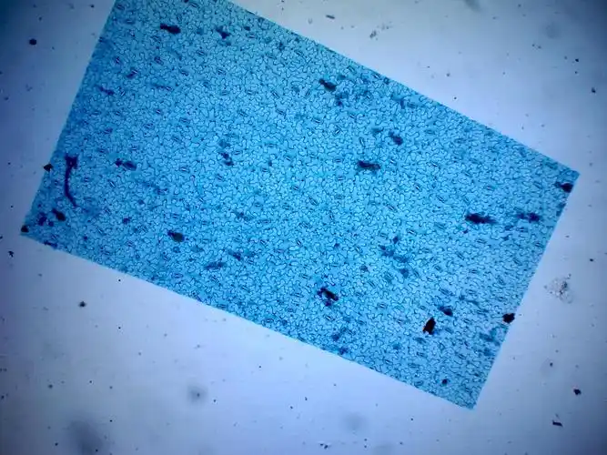 6.蚕豆叶下表皮