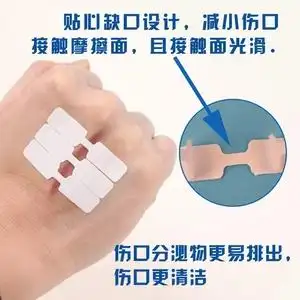 免缝胶带拉伤愈合创口j贴蝴蝶创可贴伤口免缝合创口贴拉合减张贴